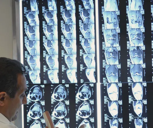 MRI films on a lightbox
