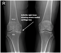 Knee | Mark Ganjianpour M.D. Orthopaedic Surgery and Sport Medicine